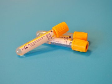 Reagenzgläser